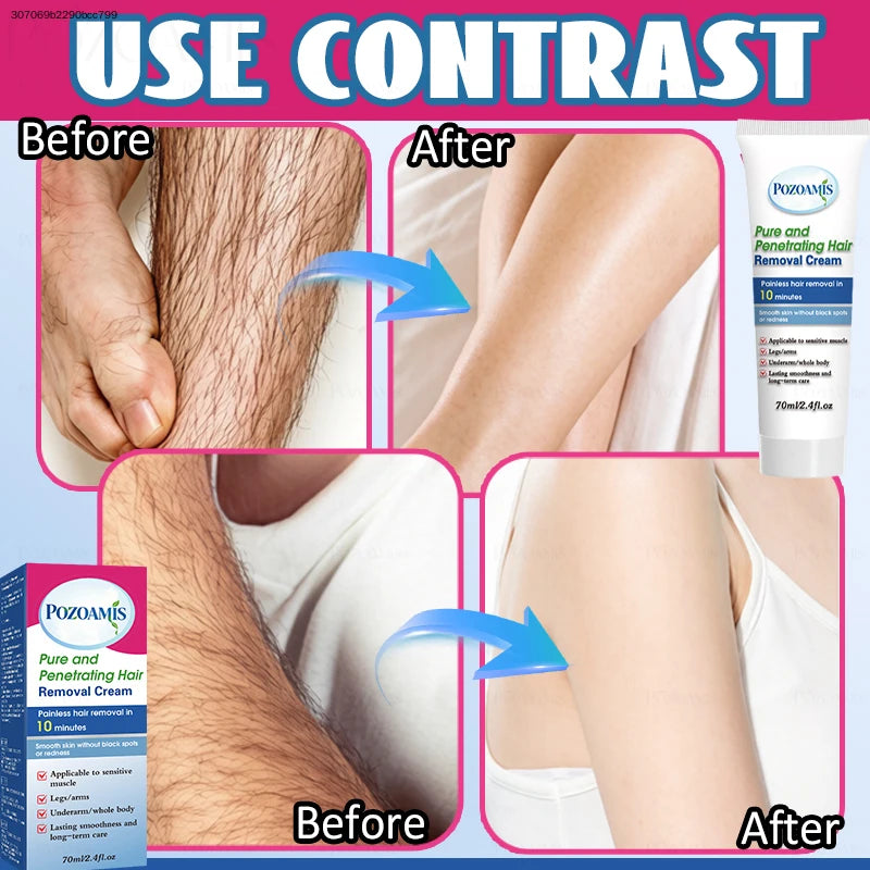 Fast-Action Painless Hair Removal Cream – Bikini, Underarm & Legs